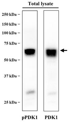 Synaptic Activity and Muscle Contraction Increases PDK1 and PKCβI Phosphorylation in the <mark class="highlighted">Presynaptic Membrane</mark> of the Neuromuscular Junction